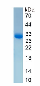 Active Carbonic Anhydrase II (CA2)