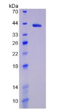 Active Hypoxia Inducible Factor 1 Alpha (HIF1a)