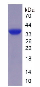 Active Pregnancy Associated Plasma Protein A (PAPPA)