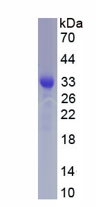 Active Pregnancy Associated Plasma Protein A (PAPPA)