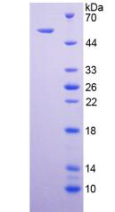 Active Death receptor 5 (DR5)