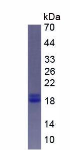 Active Parathyroid Hormone Related Protein (PTHrP)