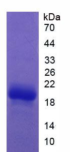 Active Coagulation Factor II (F2)