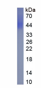 Active Cluster Of Differentiation 86 (CD86)