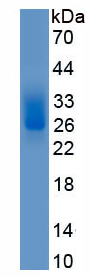 Active Von Willebrand Factor (vWF)