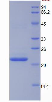 Active Nitric Oxide Synthase 2, Inducible (NOS2)