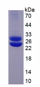 Active Prolactin (PRL)