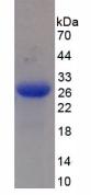 Active Mannose Associated Serine Protease 2 (MASP2)