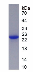 Active Carbonic Anhydrase I (CA1)