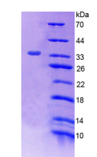 Active Tumor Protein p53 (P53)