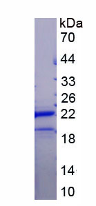 Active Retinol Binding Protein 4 (RBP4)