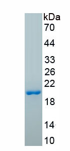 Active Acid Phosphatase 1 (ACP1)