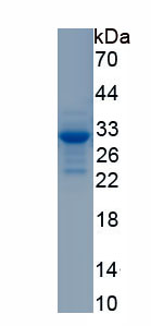 Active Cluster Of Differentiation 320 (CD320)