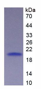 Active Tumor Necrosis Factor Receptor Superfamily, Member 7 (TNFRSF7)