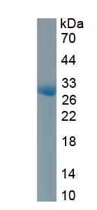Active Caspase Activated DNase (CAD)