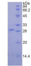 Active Glutathione S Transferase Pi (GSTp)