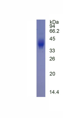 Active Cluster Of Differentiation 42b (CD42b)