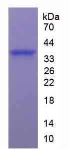 Active Arginase (ARG)