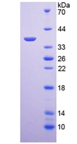 Active Arginase (ARG)