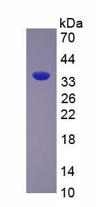 Active Arginase (ARG)