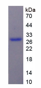 Active Chondroitin Sulfate Proteoglycan 4 (CSPG4)