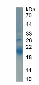 Active Chromogranin A (CHGA)