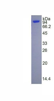 Active Cluster Of Differentiation 56 (CD56)