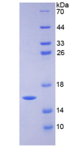 Active Heart-type Fatty Acid Binding Protein (H-FABP)