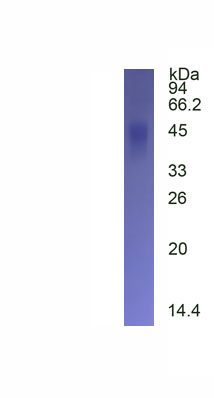 Active Fc Fragment Of IgG Low Affinity IIIa Receptor (FcgR3A)