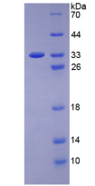 Active Vascular Endothelial Growth Factor Receptor 2 (VEGFR2)