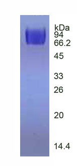 Active Vascular Endothelial Growth Factor Receptor 2 (VEGFR2)