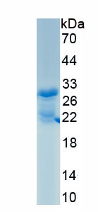 Active Proteinase 3 (PR3)