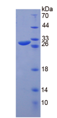 Active Chitinase-3-like Protein 1 (CHI3L1)