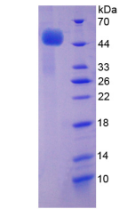 Active Tumor Necrosis Factor Receptor 1 (TNFR1)