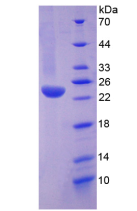 Active Tumor Necrosis Factor Receptor 1 (TNFR1)