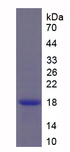 Active Secondary Lymphoid Tissue Chemokine (SLC)