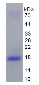 Active Interleukin 10 Receptor Beta (IL10Rb)