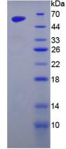 Active Golgi Phosphoprotein 2 (GOLPH2)