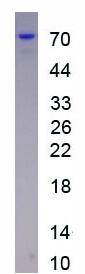 Active Angiopoietin Like Protein 3 (ANGPTL3)