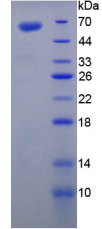 Active Transglutaminase 1 (TGM1)