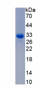 Active Complement Component 9 (C9)