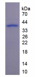 Active Interleukin 2 Receptor Alpha (IL2Ra)