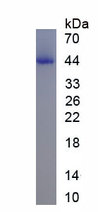 Active Angiotensin I Converting Enzyme 2 (ACE2)