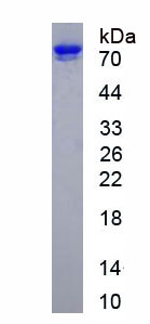 Active Angiotensin I Converting Enzyme 2 (ACE2)