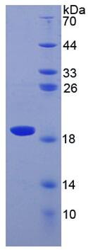 Active Superoxide Dismutase 1 (SOD1)