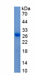 Active A Disintegrin And Metalloproteinase With Thrombospondin 7 (ADAMTS7)