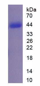 Active Complement Factor B (CFB)