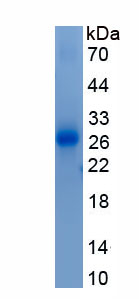 Active Interleukin 28B (IL28B)