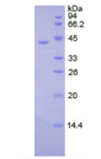 Active Creatine Kinase B (CK-BB)