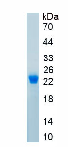 Active Afamin (AFM)